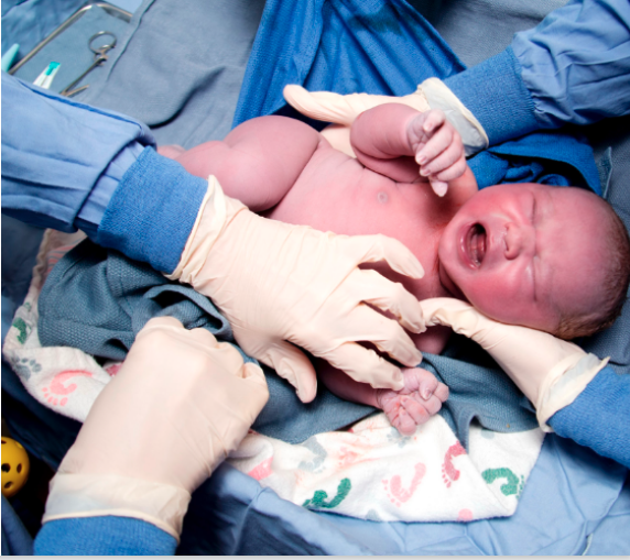 neonatal resuscitation